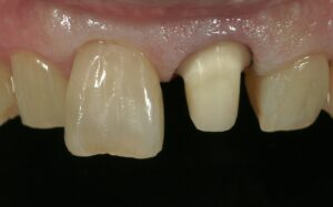 文京区豊島区茗荷谷千石髙橋歯科クリニック文京