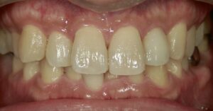 文京区豊島区茗荷谷千石歯医者髙橋歯科クリニック文京