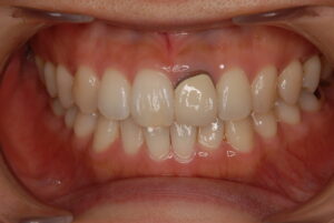 文京区豊島区茗荷谷千石髙橋歯科クリニック文京