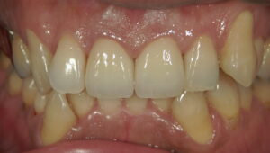 文京区千石豊島区茗荷谷歯医者髙橋歯科クリニック文京