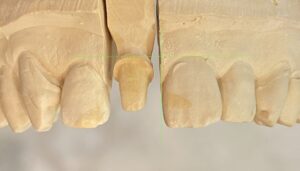 　文京区豊島区茗荷谷千石歯医者高橋歯科クリニック文京